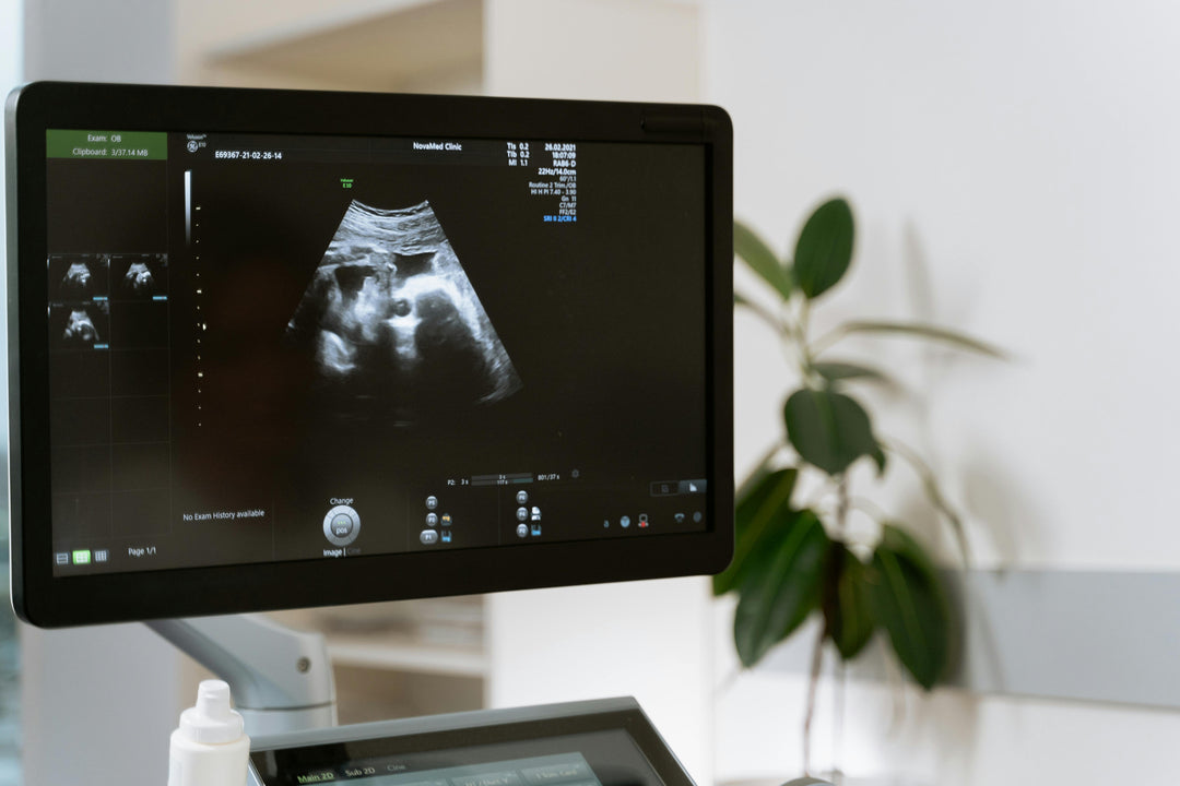 Servicio de Ultrasonido Veterinario Abdominal para Mascotas en HappyVet